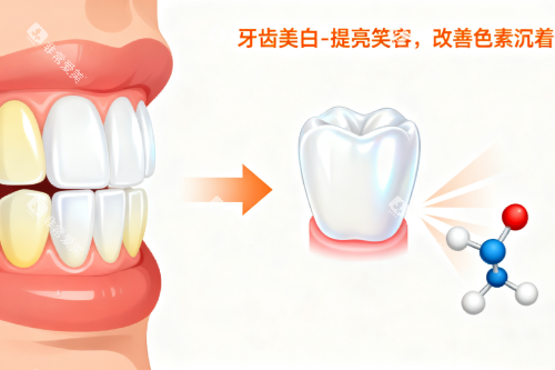 牙齿美白卡通图片一览