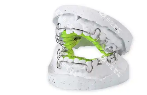 牙齿矫正扩弓器