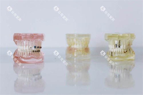 牙齿材料模型