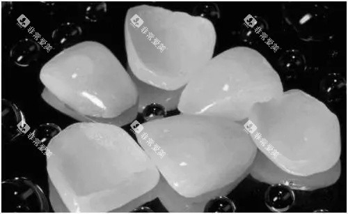 贴面材料示意图
