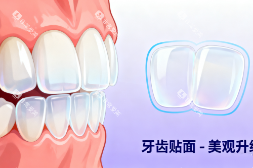 牙齿贴面美白牙齿卡通图