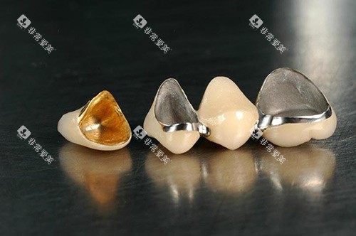 全瓷牙冠材料展示