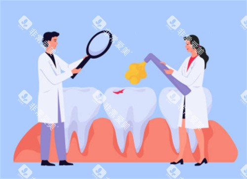 牙齿检查示意图