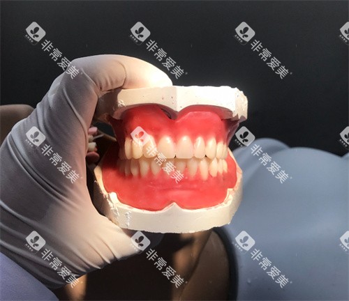 全口义齿模型展示