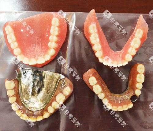 不同材料的义齿实物展示图