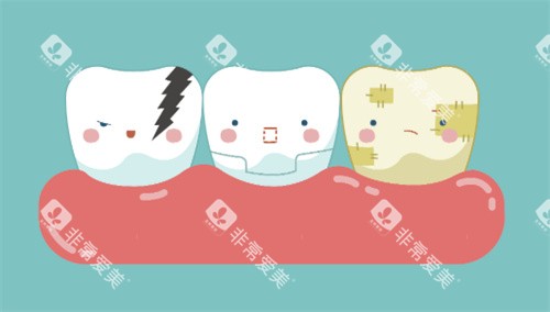 牙齿美白对比卡通图