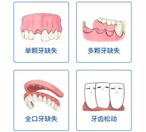 单颗多颗全口牙齿缺失及牙齿松动漫画图