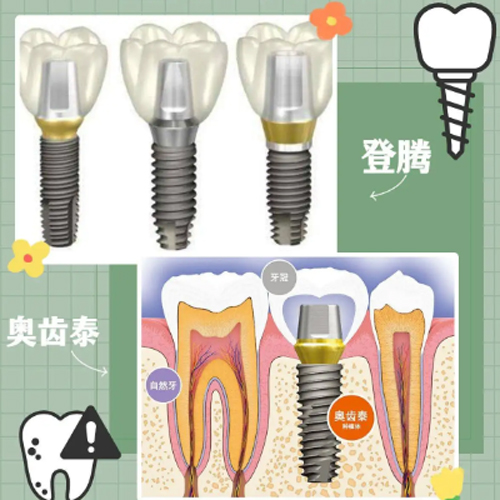 登腾奥齿泰动画图