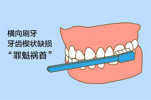 楔状缺损的罪魁祸首横向刷牙示意图