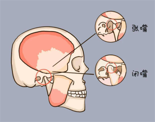 颞下颌关节紊乱会疼的位置