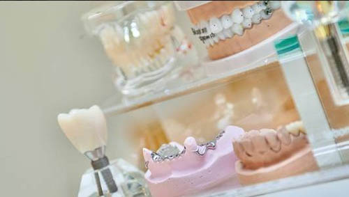 牙齿模具图 牙齿模具图