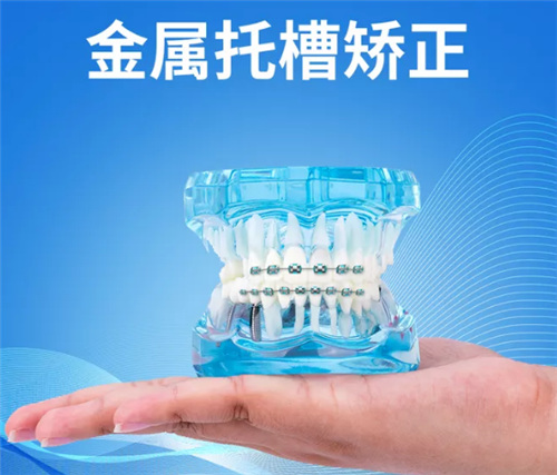金属托槽矫正牙套