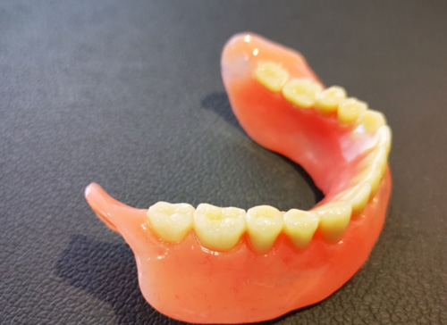 半口义齿 半口义齿