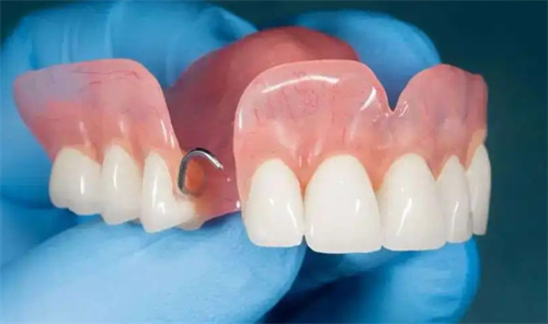 半口假牙照片 半口假牙照片