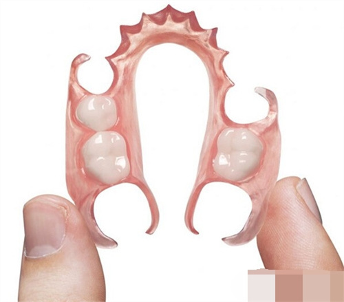 假牙模型照片 假牙模型照片