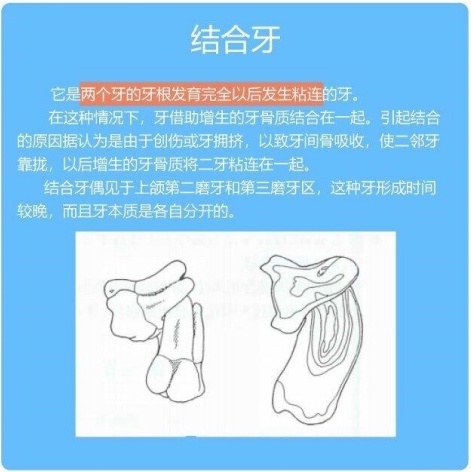 结合牙介绍示意图