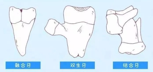 融合牙结合牙双生牙漫画图
