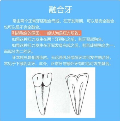 融合牙介绍示意图