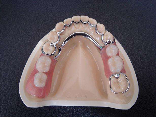 牙齿义齿假牙模型