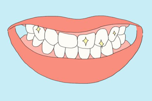 牙齿美白改善图展示 牙齿美白改善图展示