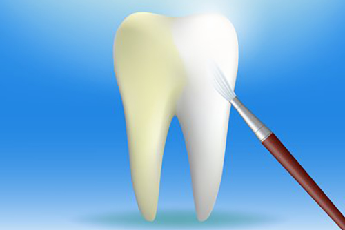 牙齿美白卡通宣传图 牙齿美白卡通宣传图