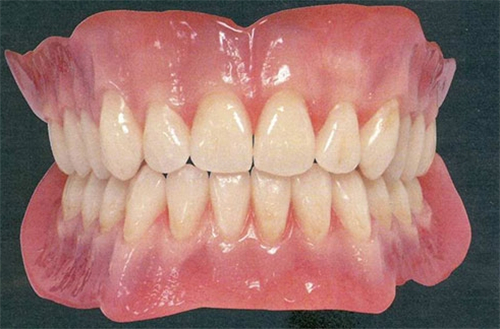 还原真牙的全瓷牙 还原真牙的全瓷牙