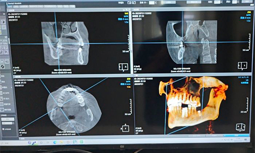 杭州雅莱口腔牙片展示图 杭州雅莱口腔牙片展示图