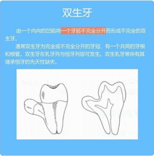 双生牙介绍示意图