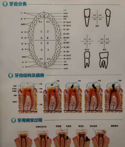 牙齿龋坏发展过程图
