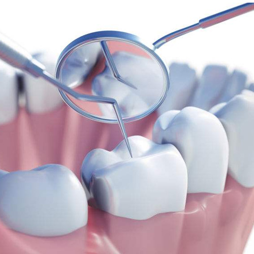 牙齿检查图示 牙齿检查图示