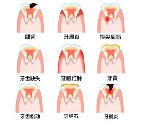 不同牙齿问题