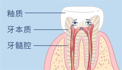 牙齿变黄怎么办