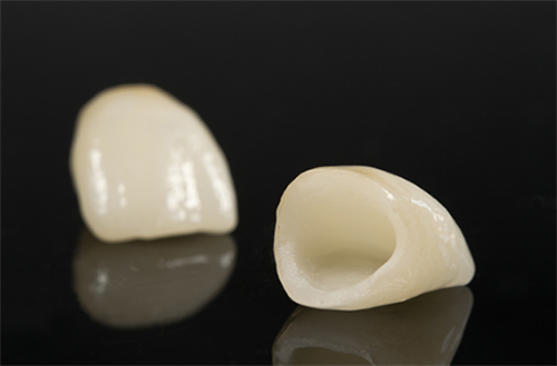 全瓷牙套 全瓷牙套