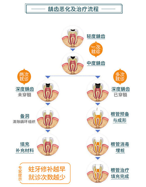 龋齿恶化示意图