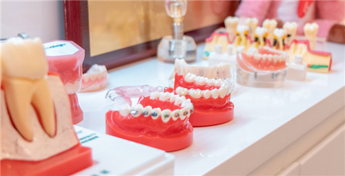 牙套牙模展示.jpg