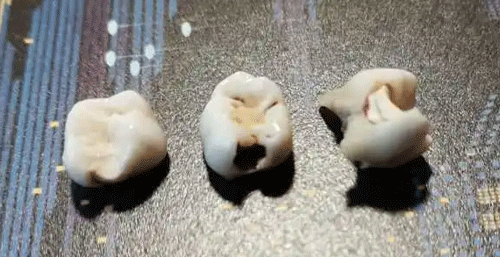 拔掉的坏牙 拔掉的坏牙