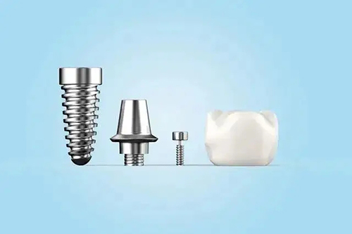 种植牙不同部件模型示意图 种植牙不同部件模型示意图