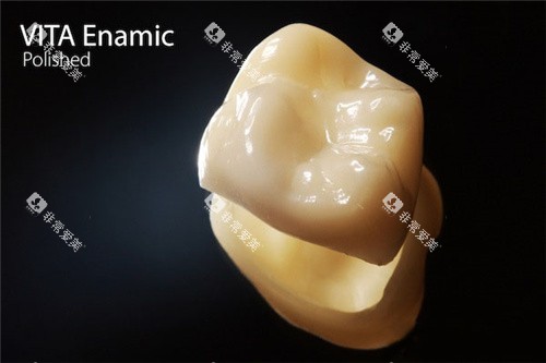 vita全瓷牙