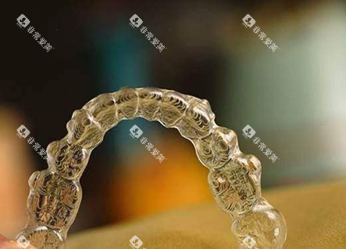 隐形矫治器示意图 隐形矫治器示意图