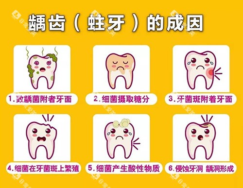 龋齿