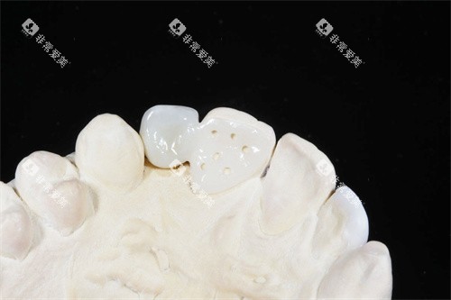 马里兰桥成品