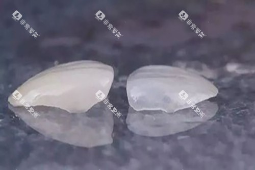 树脂和全瓷贴片实物示意图