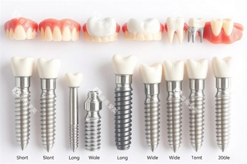 各种型号的种植体