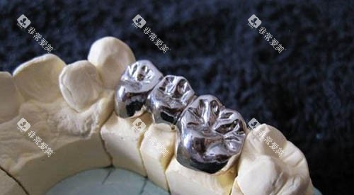 牙冠修复图