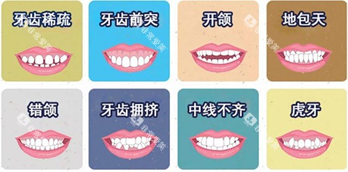 牙齿矫正不同适应症漫画图