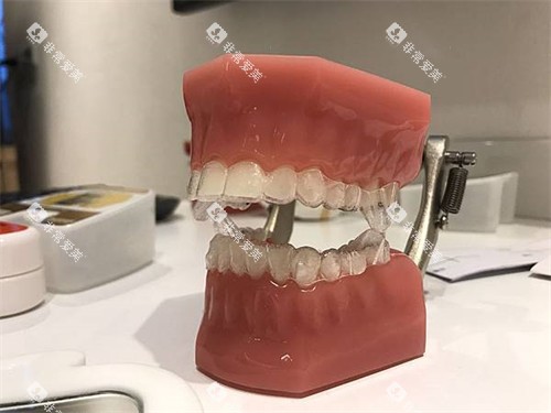 隐形牙齿矫正牙套模型