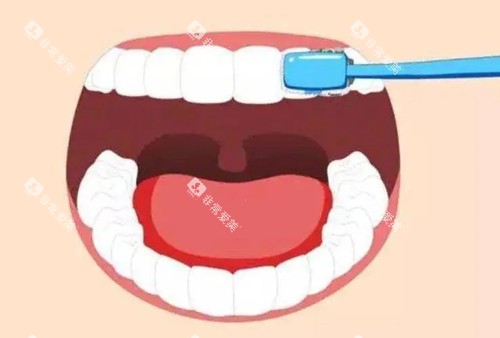 刷牙卡通示意图