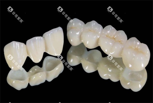 连冠的全瓷牙