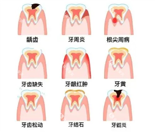 不同牙齿问题