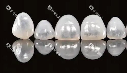 德国vita全瓷牙展示图